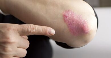 Beneficios de acudir al dermatólogo ante cualquier signo de dermatitis atópica